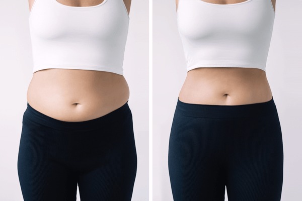 10,712 Before After Weight Loss Royalty-Free Images, Stock Photos &  Pictures | Shutterstock