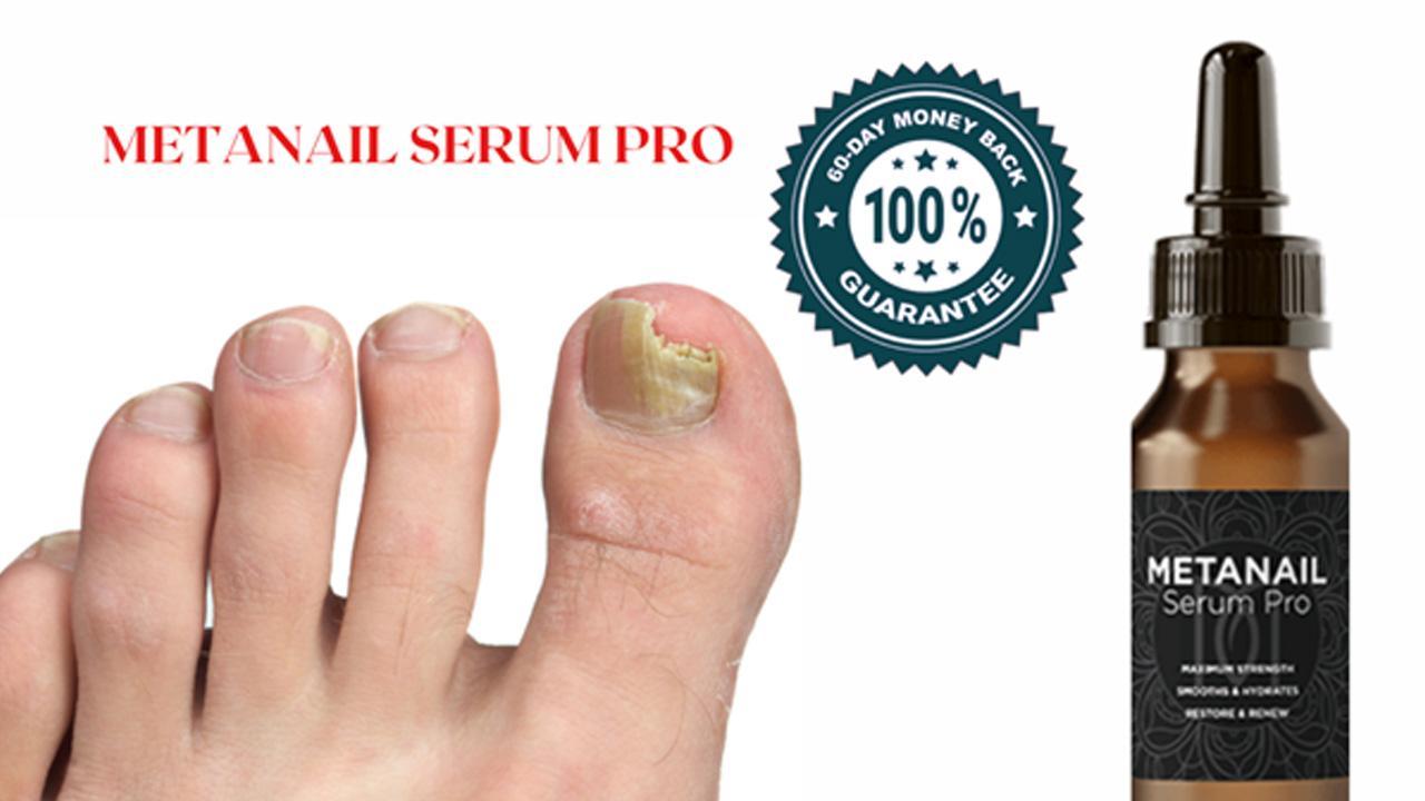 Metanail Serum Pro Reviews Should You Buy Metanail Complex, 55% OFF Metanail Serum Pro Reviews Should You Buy Metanail Complex, 55% OFF